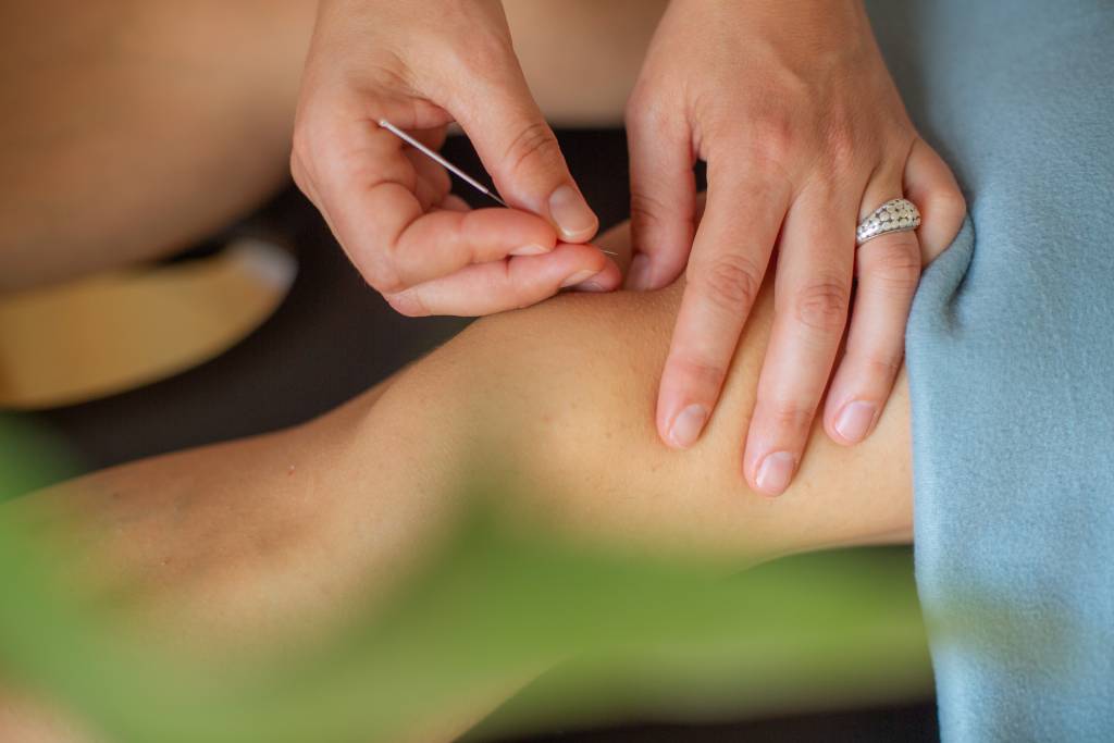 acupuntura barcelona 2