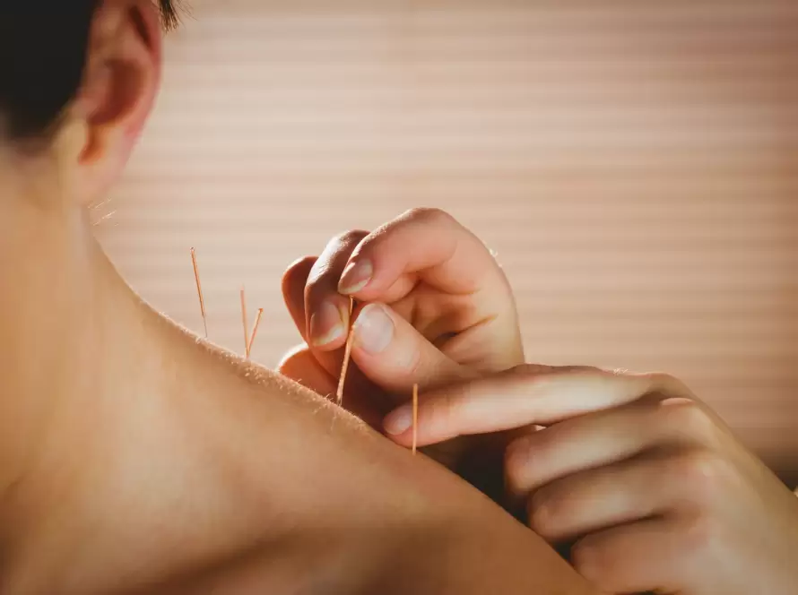 Acupuntura en Barcelona Salud integral desde la raíz